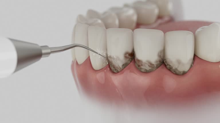 Reliable Dental Implants contractor in Cambridge, WI by Smile Center Dentistry